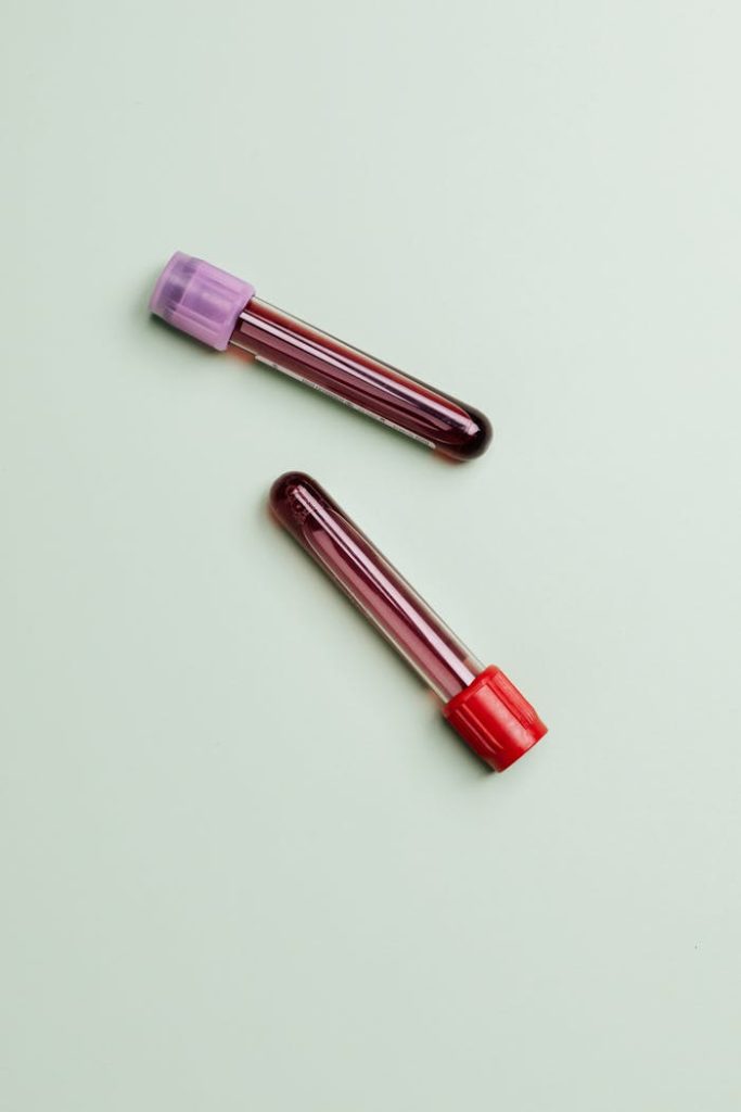 Close-up of two blood sample tubes on a light green background.